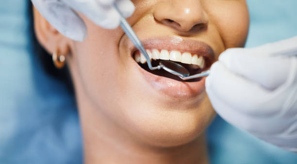 Best Emergency Dental Care for Broken or Chipped Teeth in Crafton, PA