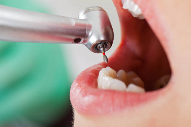 Best Emergency Treatment for Dental Infections or Abscesses in Crafton, PA